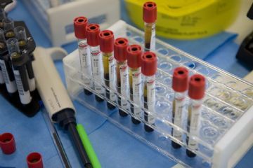 Calendario dell'ambulatorio prelievi 2026- Tavagnasco e Quassolo